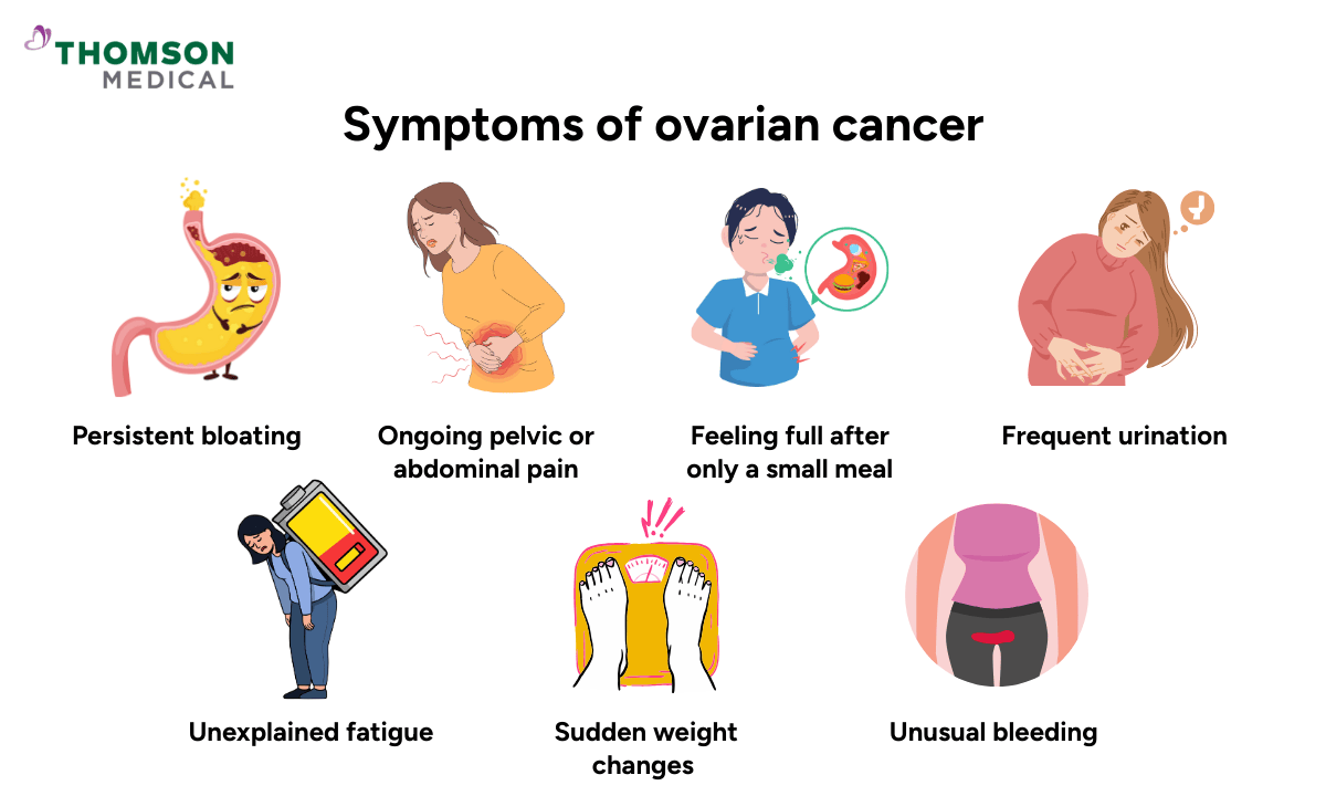symptoms-of-ovarian-cancer