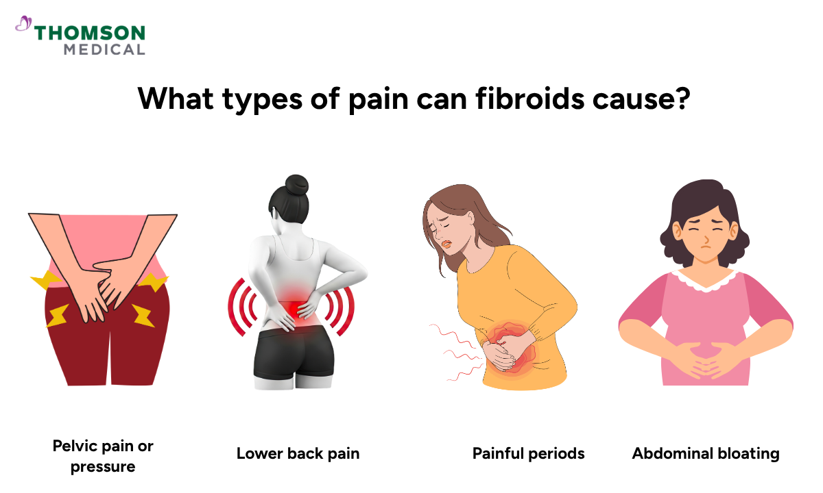Illustration of the types of pain can fibroids cause
