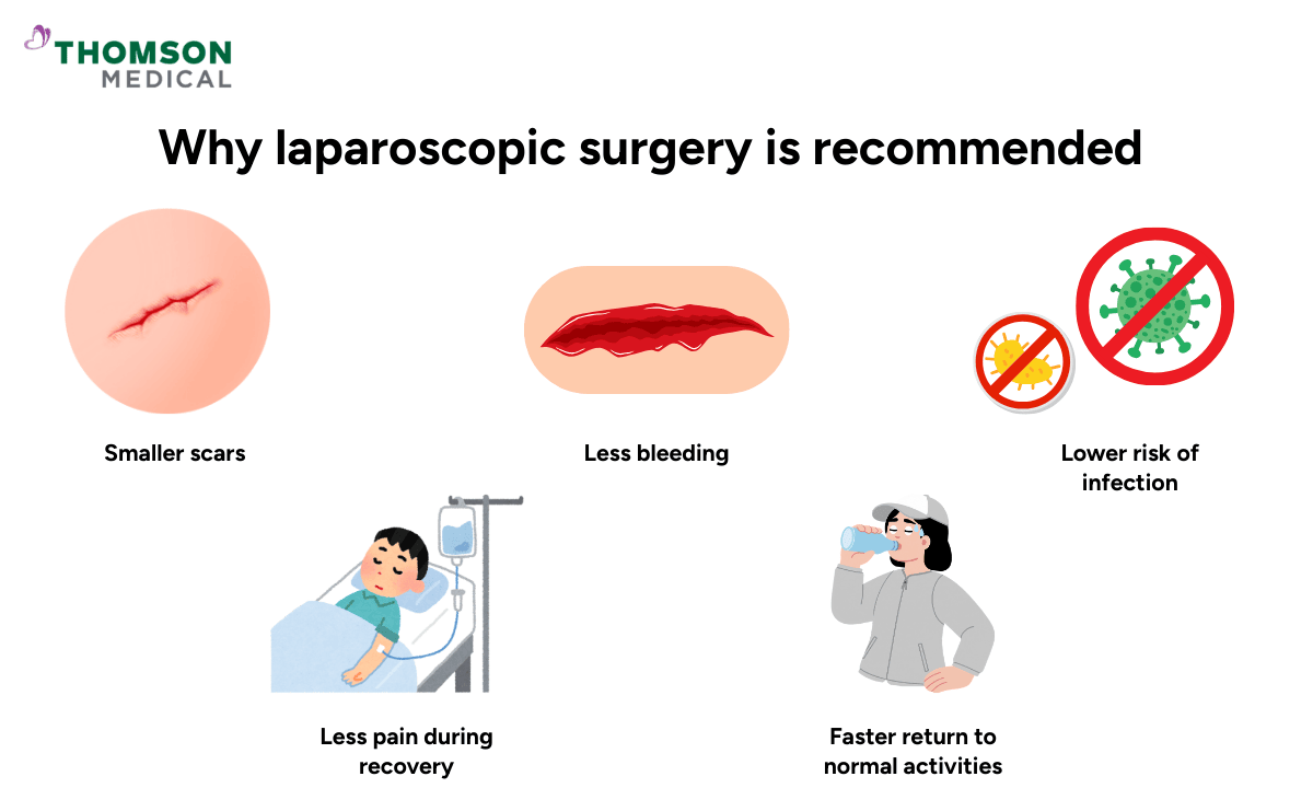 why-laparoscopic-surgery-is-recommended