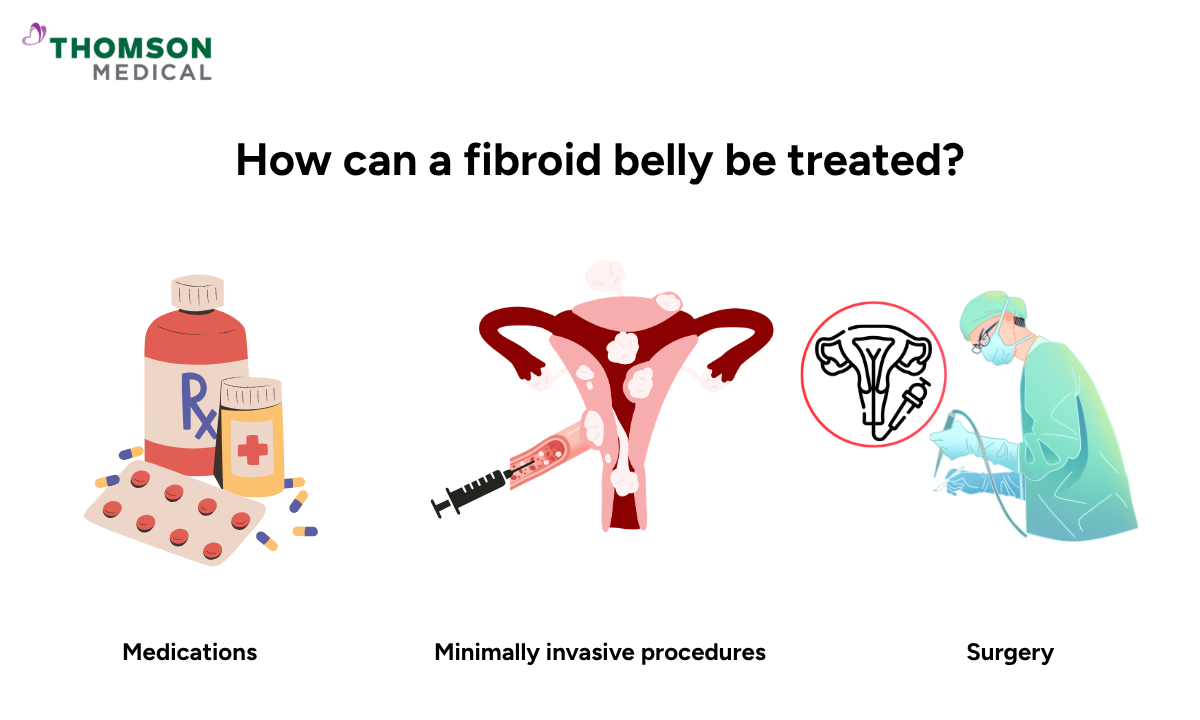 Illustration on how can a fibroid belly be treated