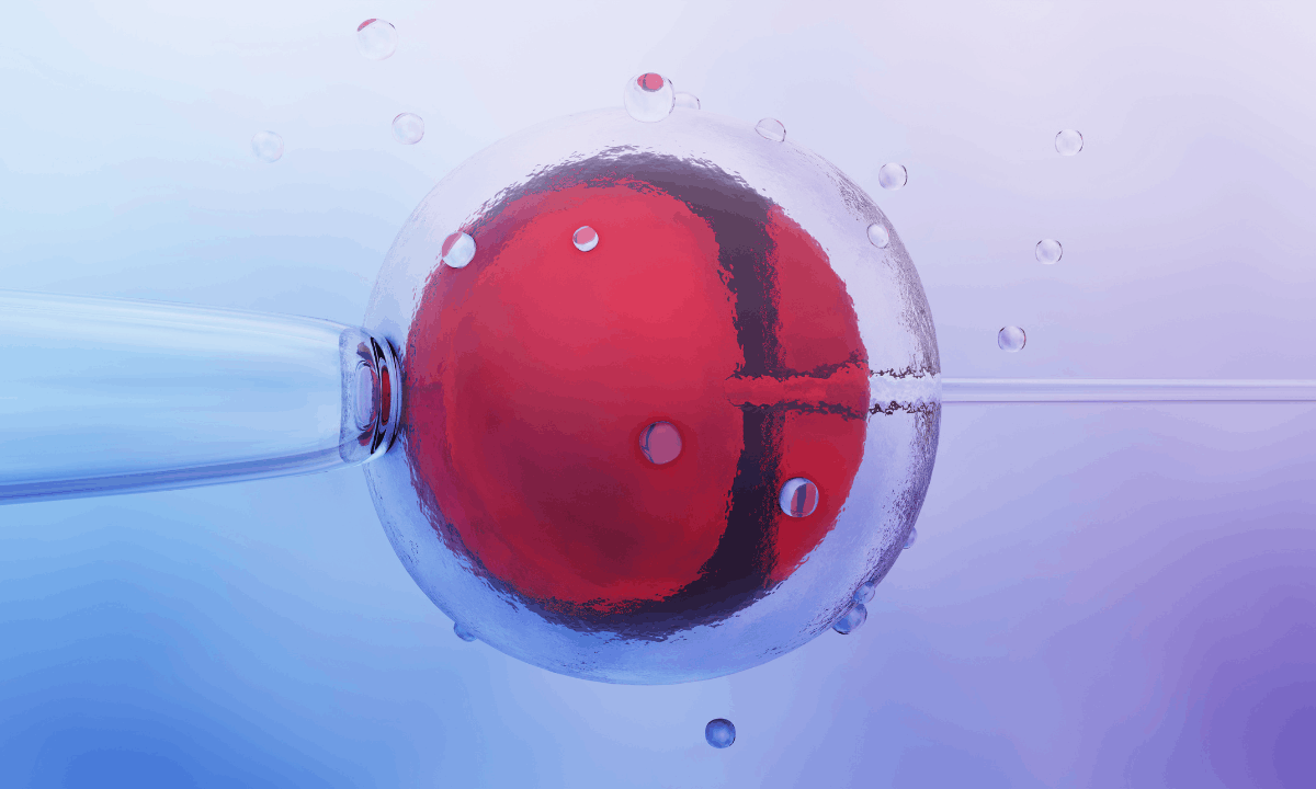 illustration of an IVF procedure