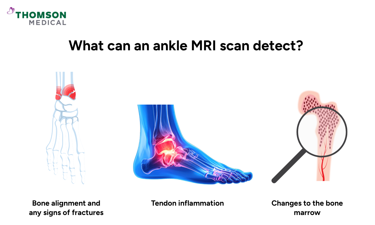 Illustration of what can an ankle MRI scan detect