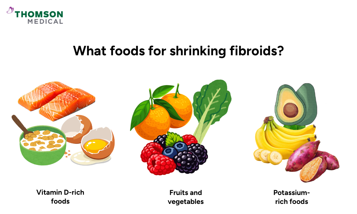 Illustration shows which foods may help with fibroids.