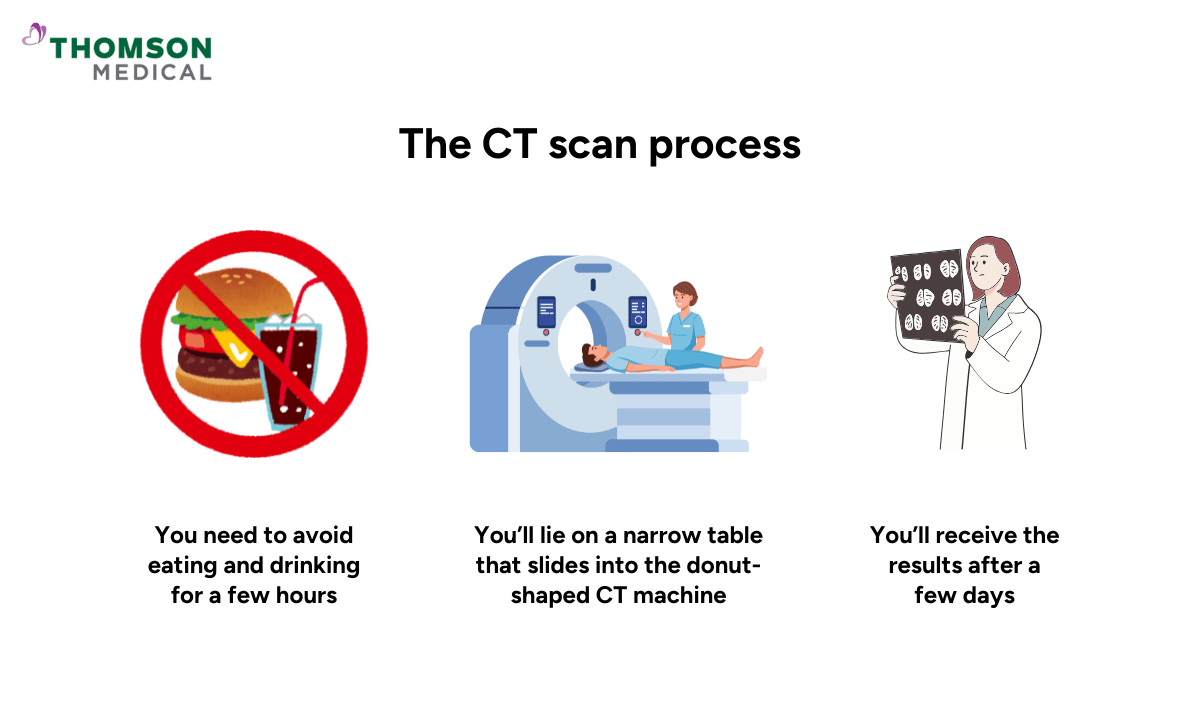 blog-image_obgyn_the-ct-scan-process.png
