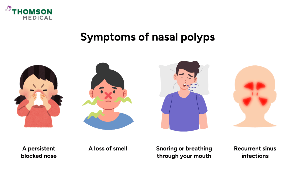symptoms-of-nasal-polyps