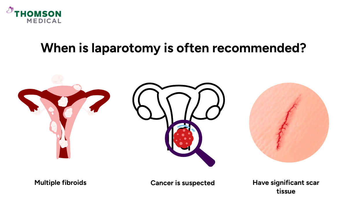 Illustration of when laparotomy is often recommended