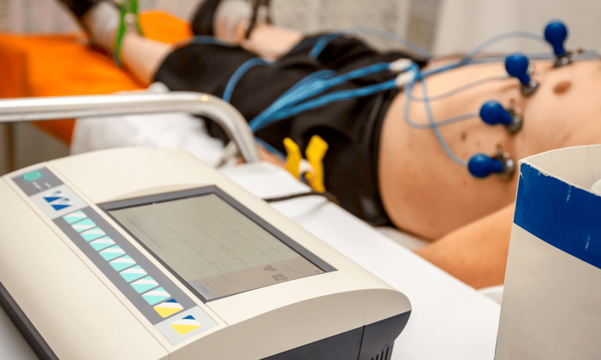 image of ecg test