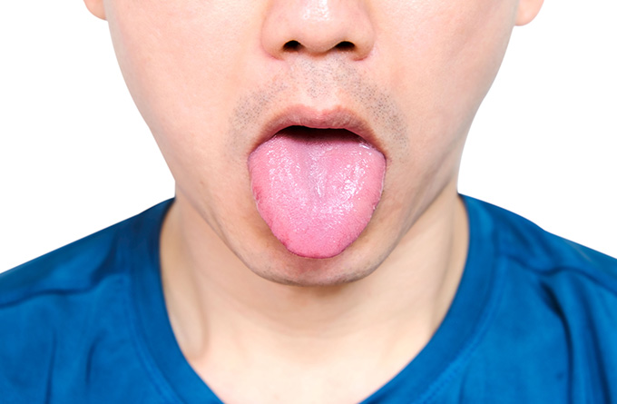 Diagnosis through inspecting the tongue