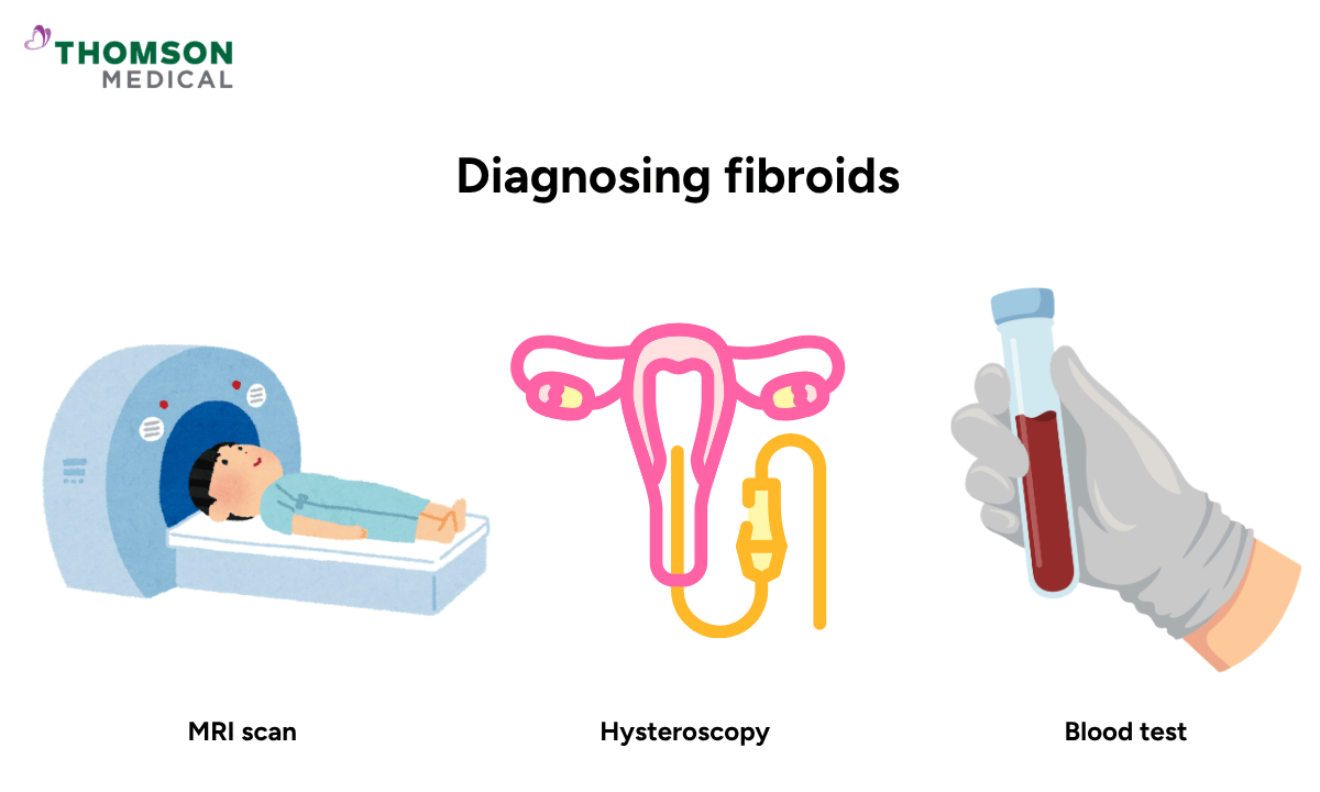 Illustration of diagnosing fibroids