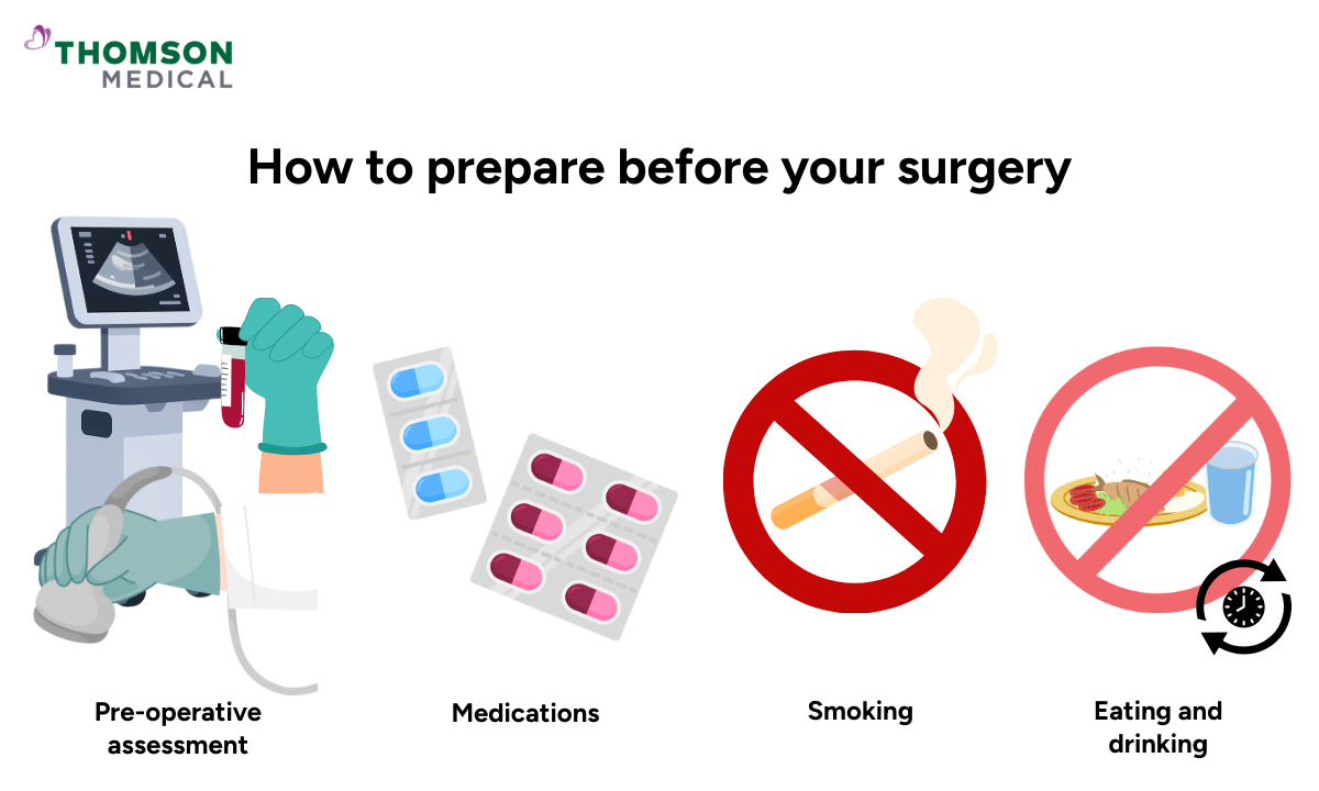 Illustration of how to prepare for a smoother recovery post-surgery