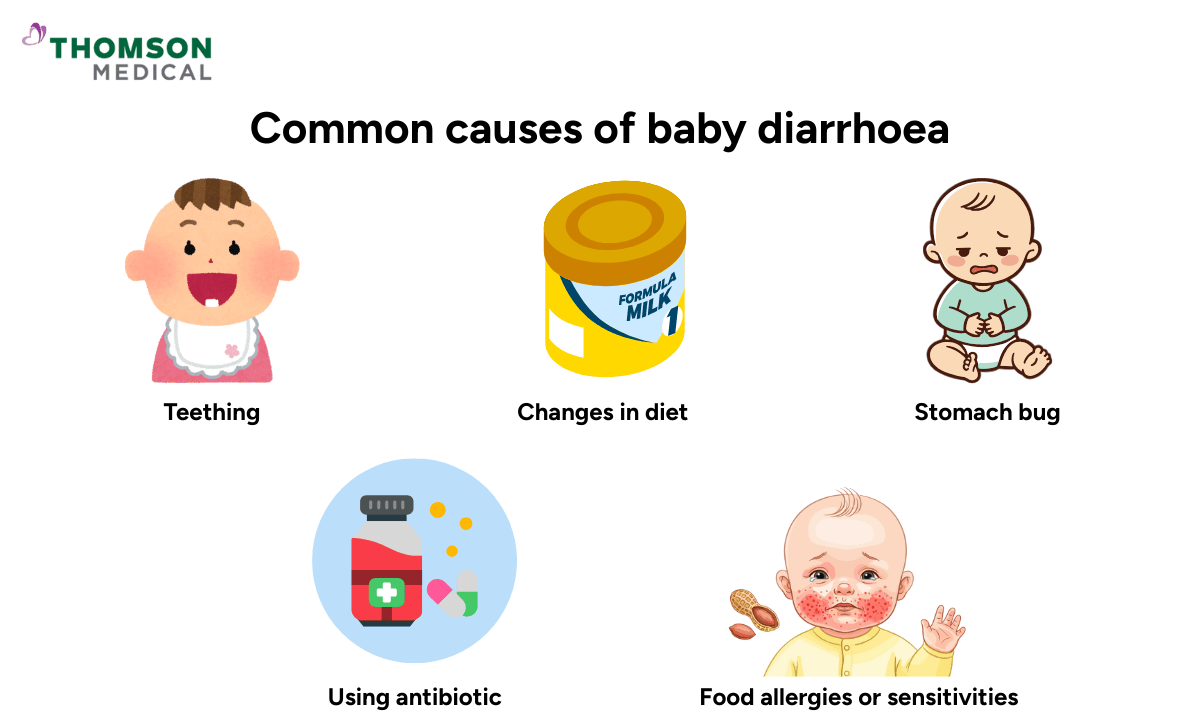 image of common causes of baby diarrhoea