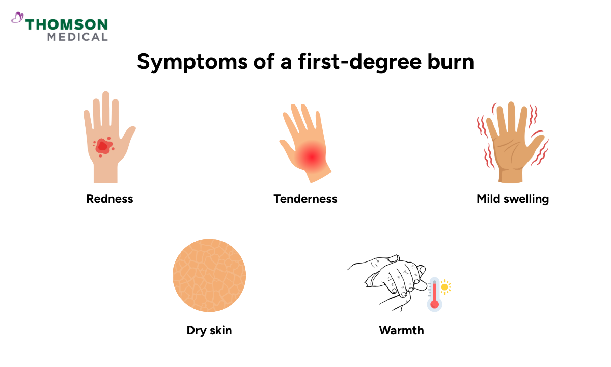 blog-image_ucc_symptoms-of-a-first-degree-burn.png