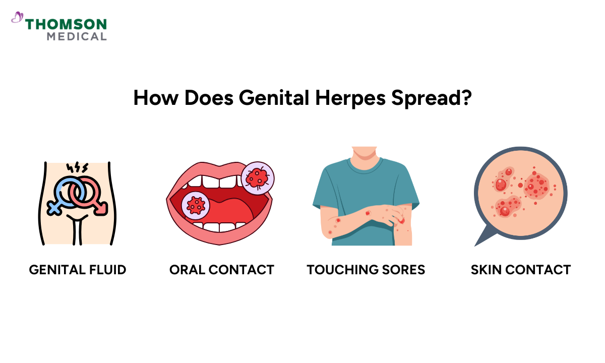 how does genital herpes spread?
