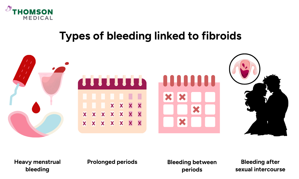 The illustration shows the types of bleeding linked to fibroids