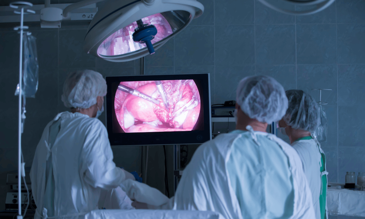 doctors-perform-laparoscopic-surgery