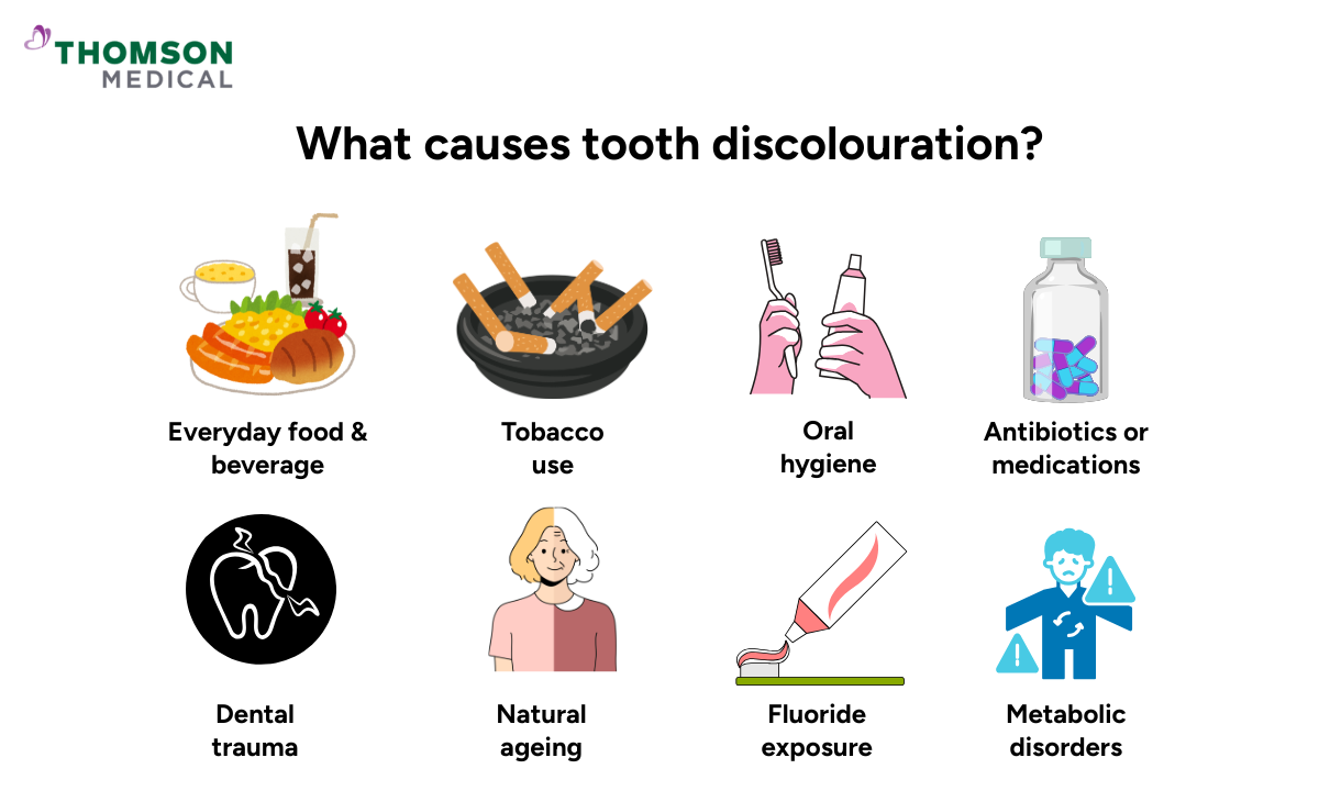 illustration of what causes tooth discolouration