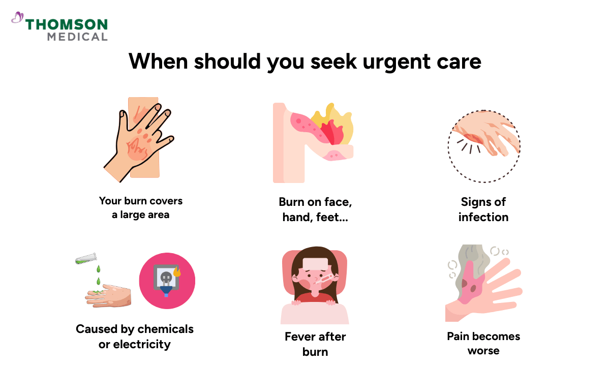 blog-image_ucc_when-to-seek-urgent-care-first-degree-burn.png
