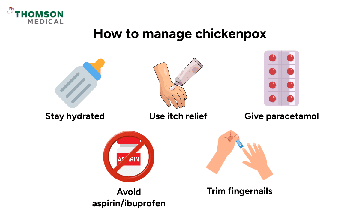 An infographic on how to manage chickenpox