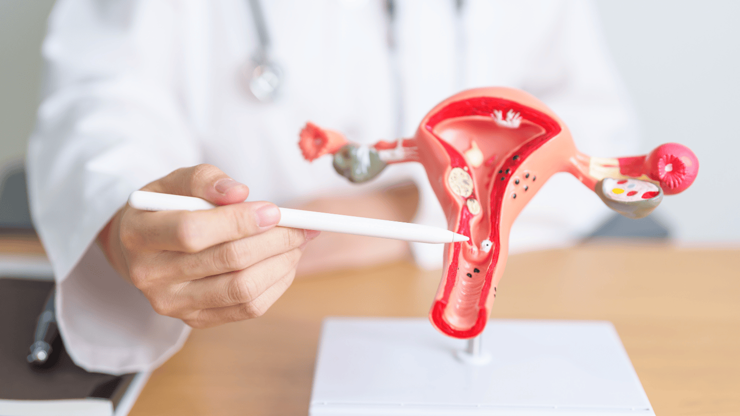 image of a model of women reproductive organ