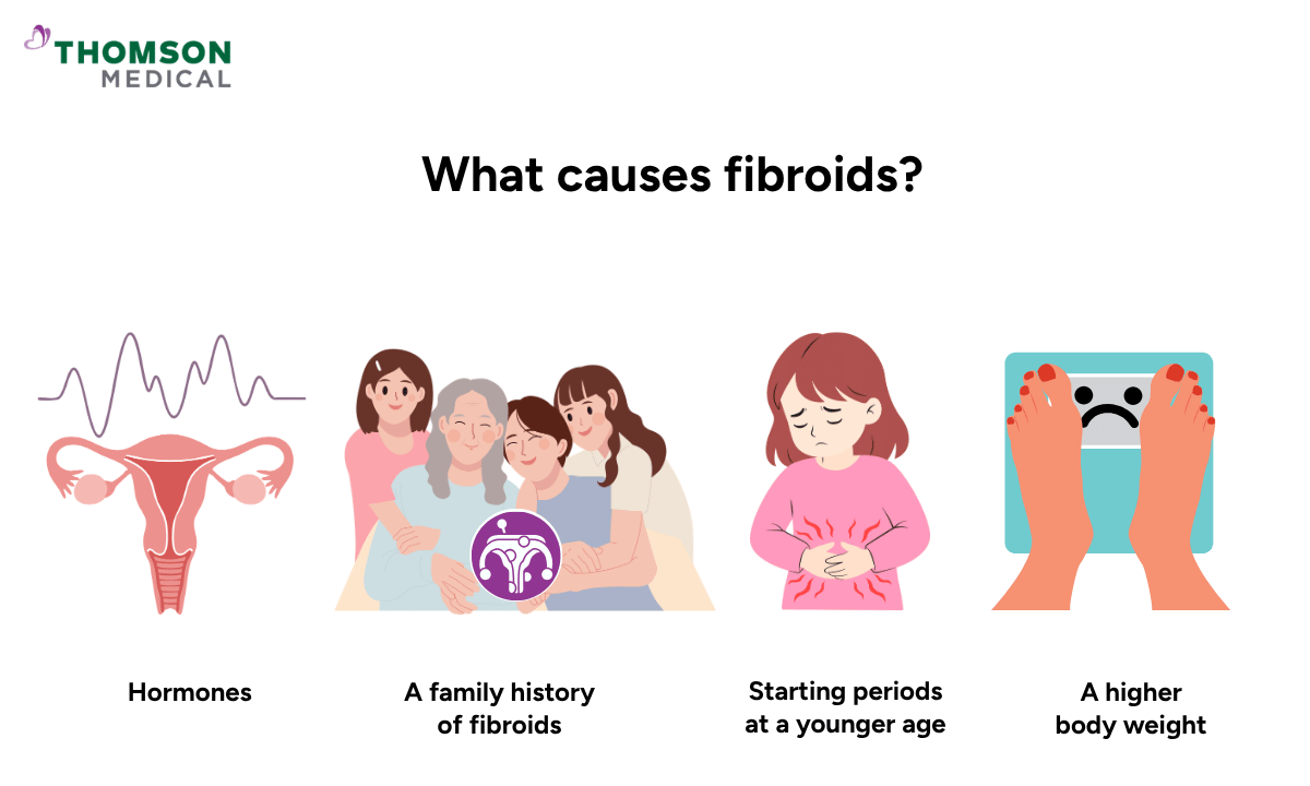 illustration of what causes fibroids