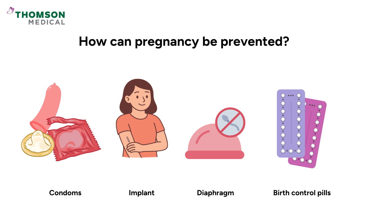 illustration of how can pregnancy be prevented?