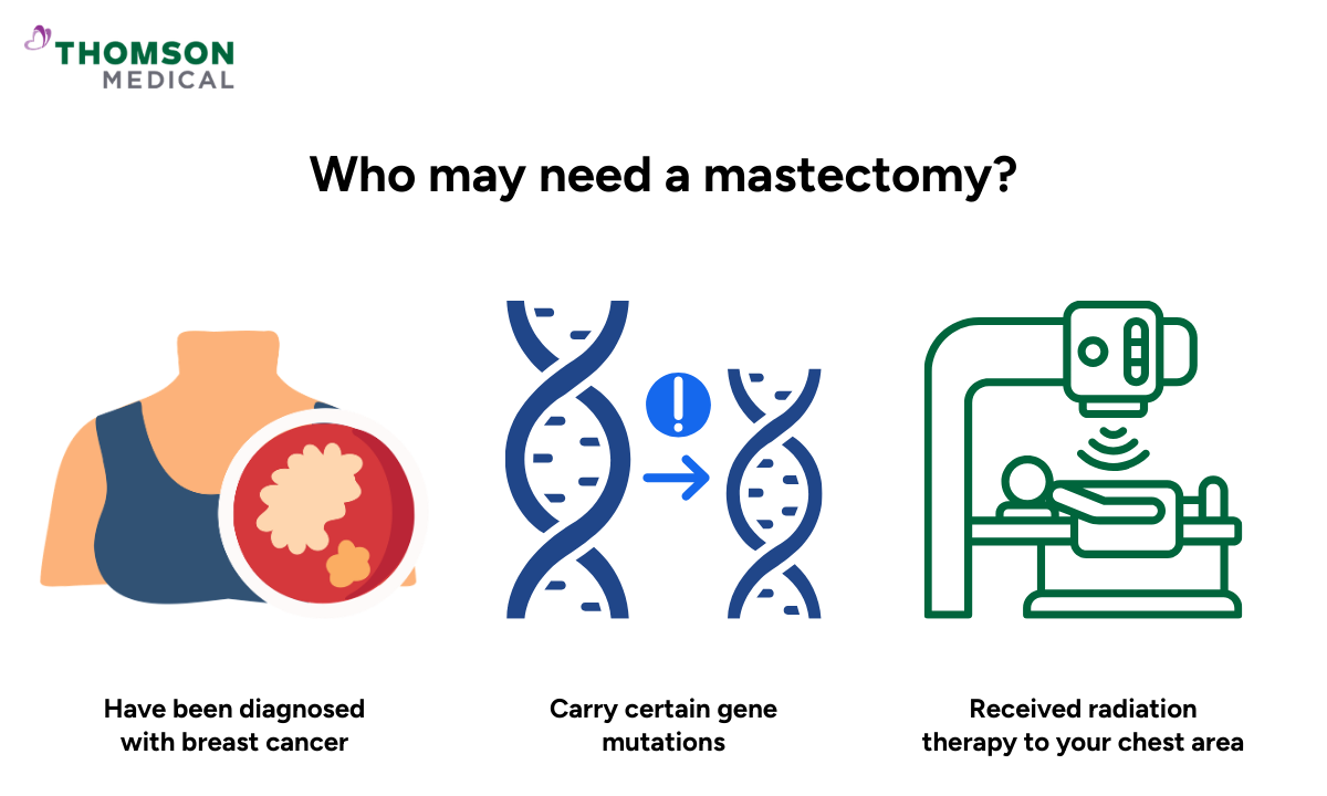 Illustration showing who may need a mastectomy