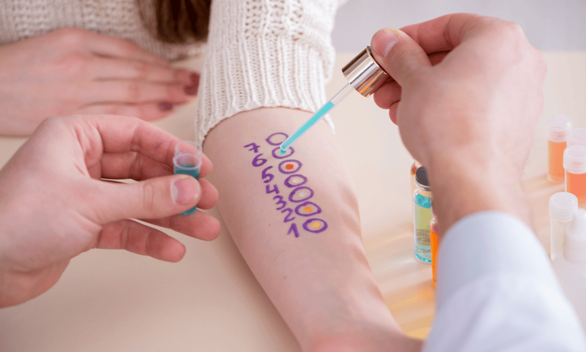 blog-image_screening_skin-prick-test.png