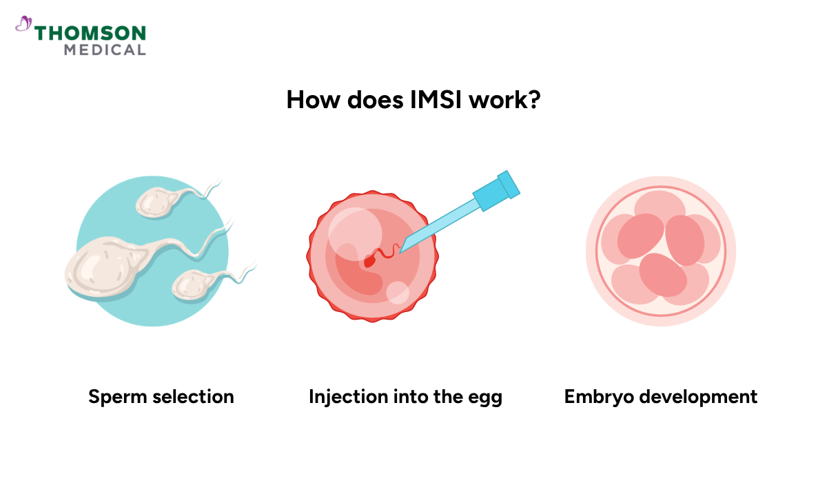 Illustration of how IMSI works