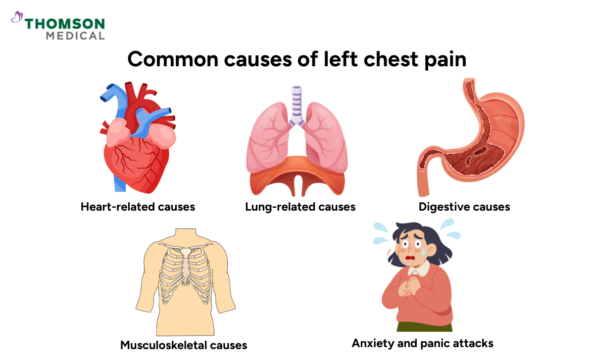 image of common causes of left chest pain