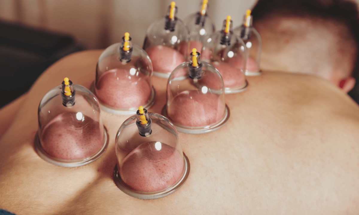 Man experiencing cupping on his back