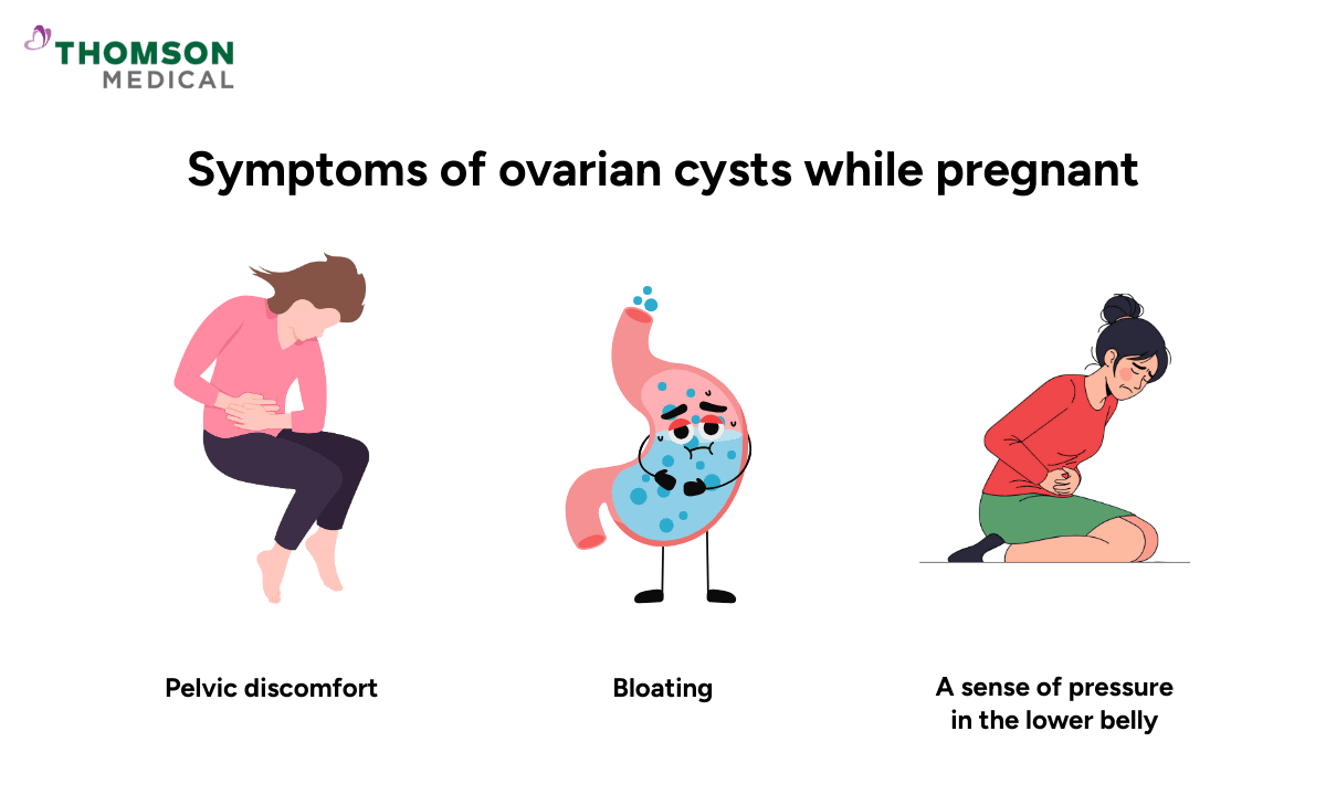 3-symptoms-of-ovarian-cysts-while-pregnant