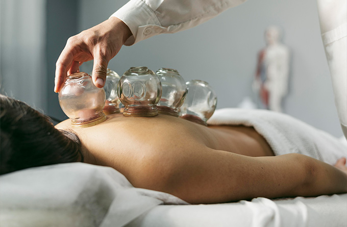 Patient undergoing cupping as part of TCM treatment.jpg