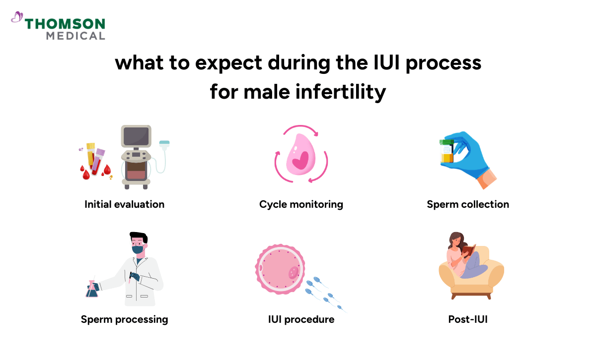 blog-image_obgyn_the-IUI-process-for-male-infertility.png