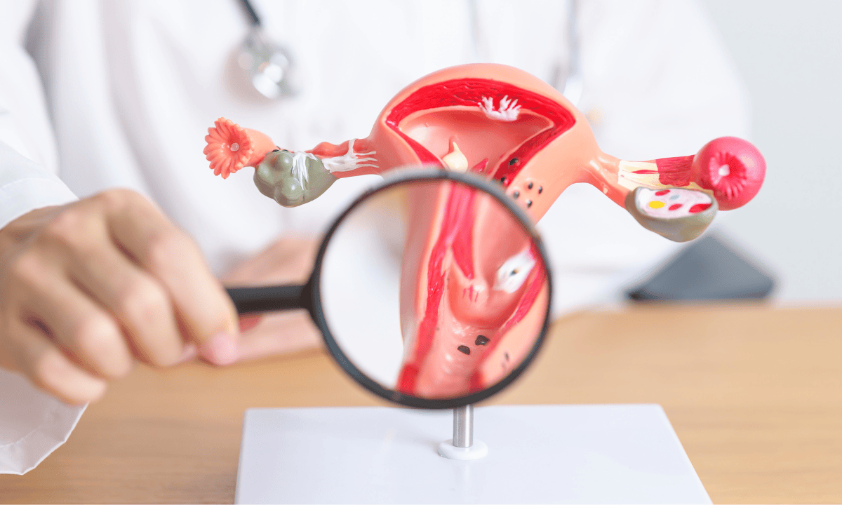 Cervix model showing abnormal cells for cervical cancer screening