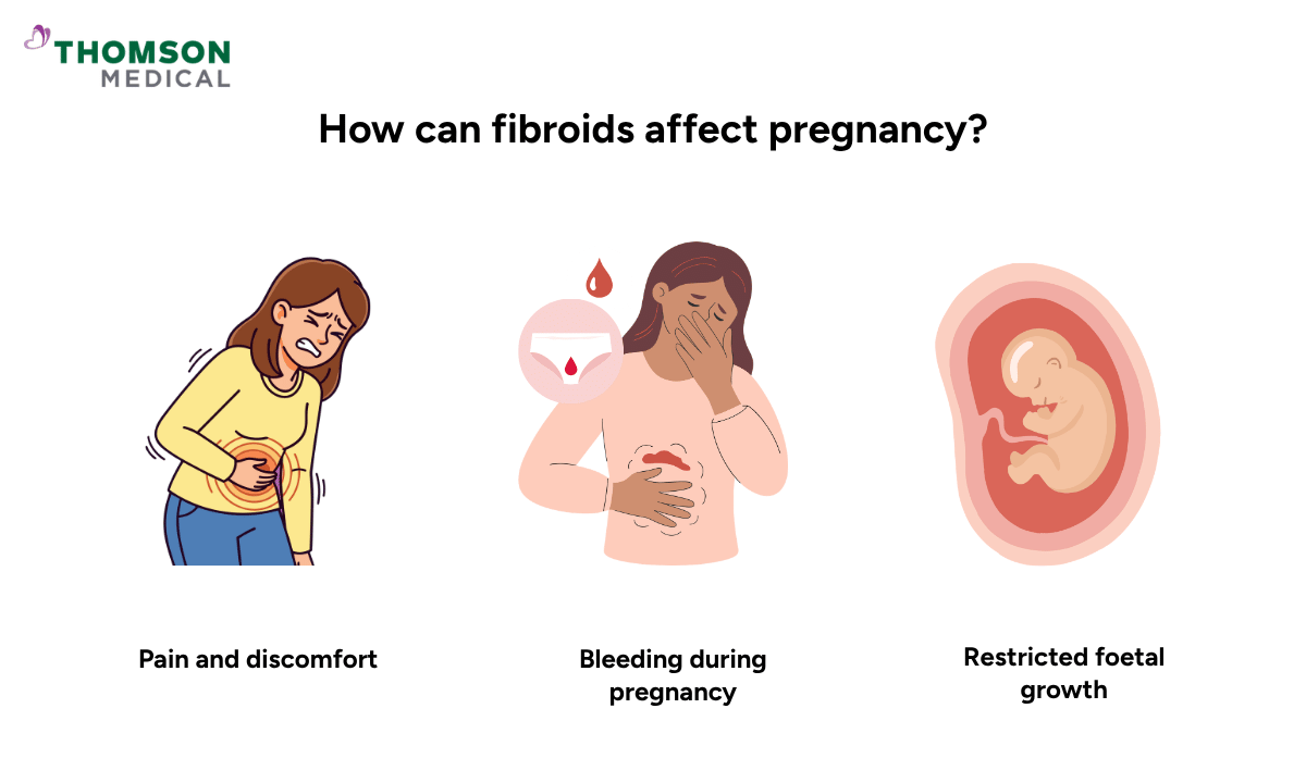 illustration of how can fibroids affect pregnancy