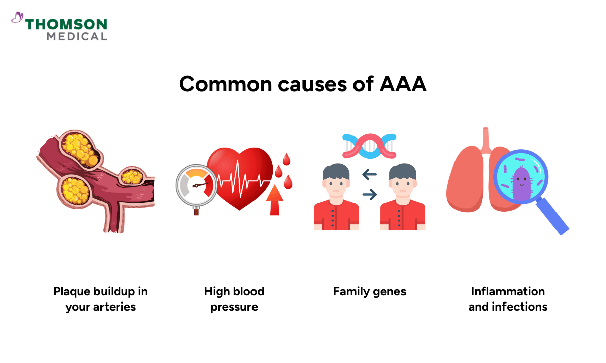 common-causes-of-aaa