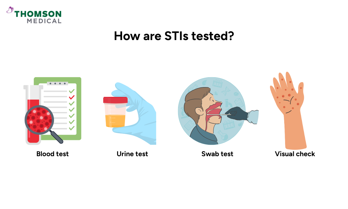 Illustration of how are STIs tested