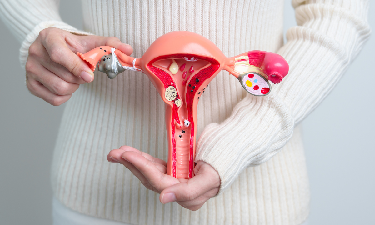 Illustration of a uterus