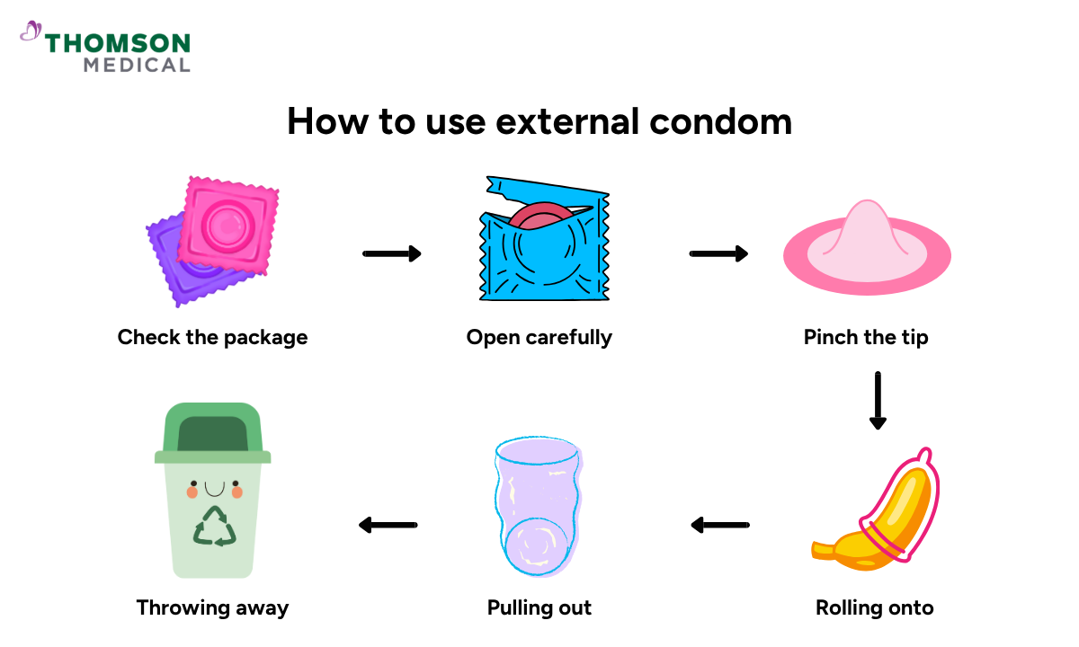 illustration about how to use external condom