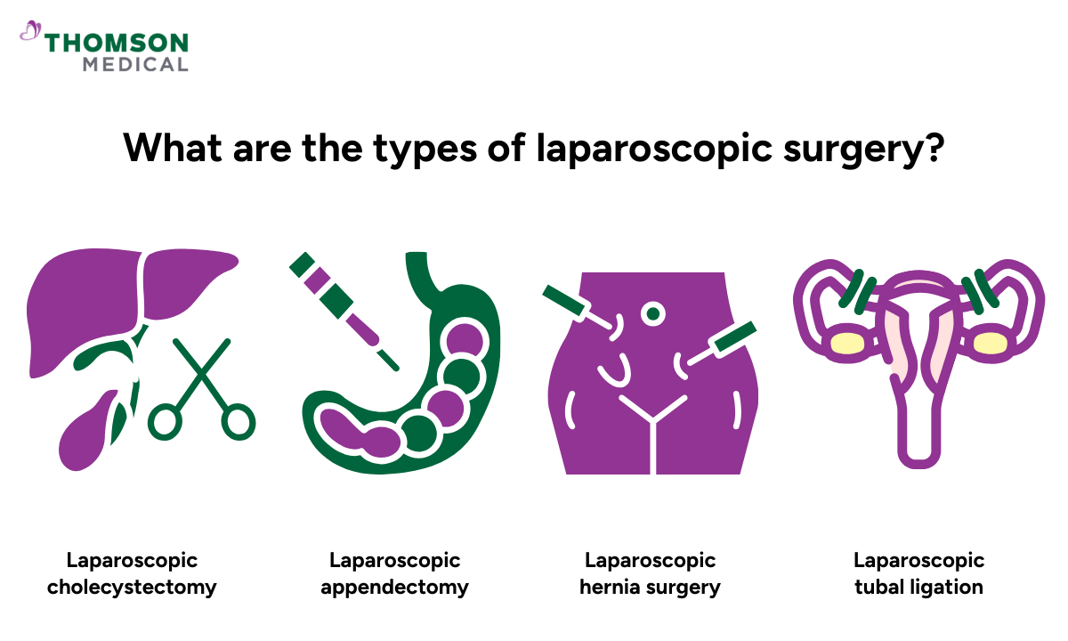 Illustration of what are the types of laparoscopic surgery