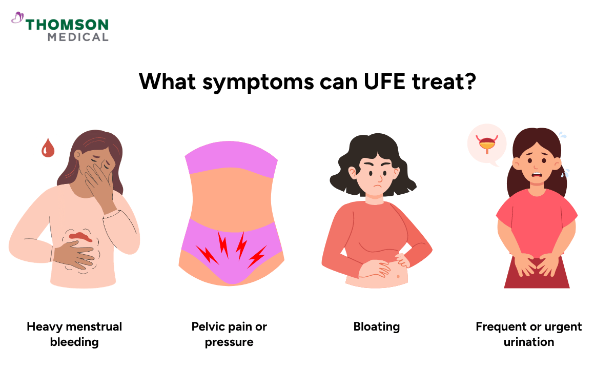 illustration of what symptoms can UFE treat