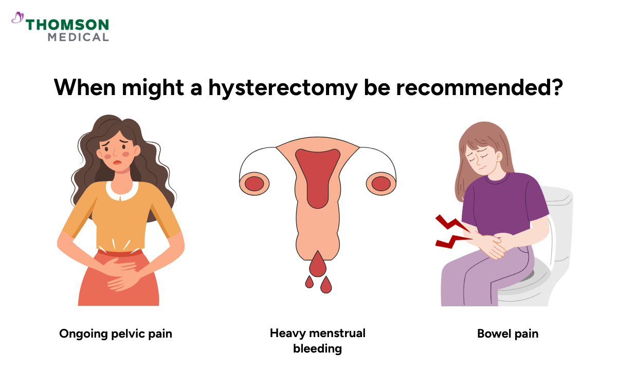 Illustration of when a hysterectomy might be recommended