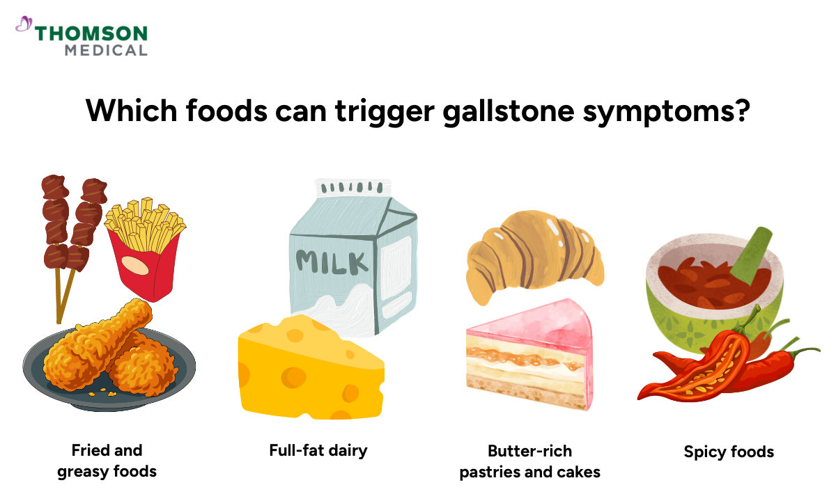 Illustration of which foods can trigger gallstone symptoms