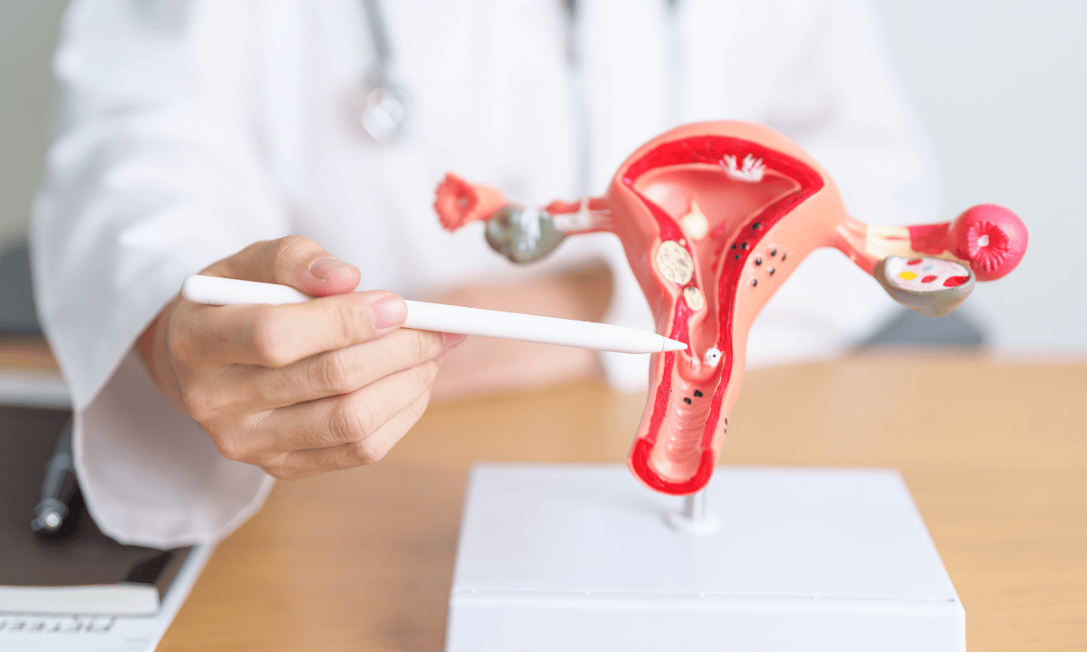 Doctor pointing at cervix