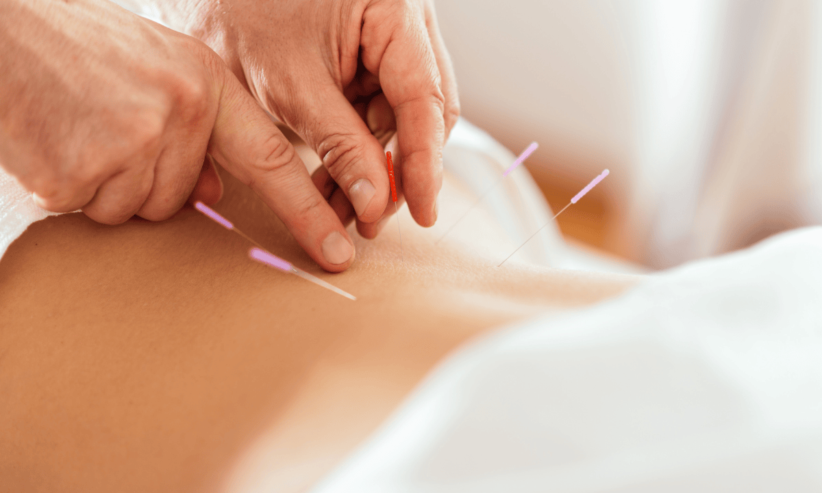 blog-image_obgyn_acupuncture-on-the-back.png