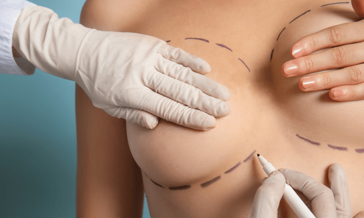 A healthcare professional measuring the breast size of a woman