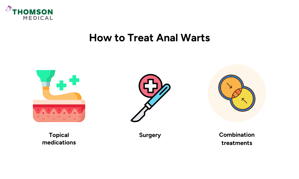 illustration of anal warts treatments