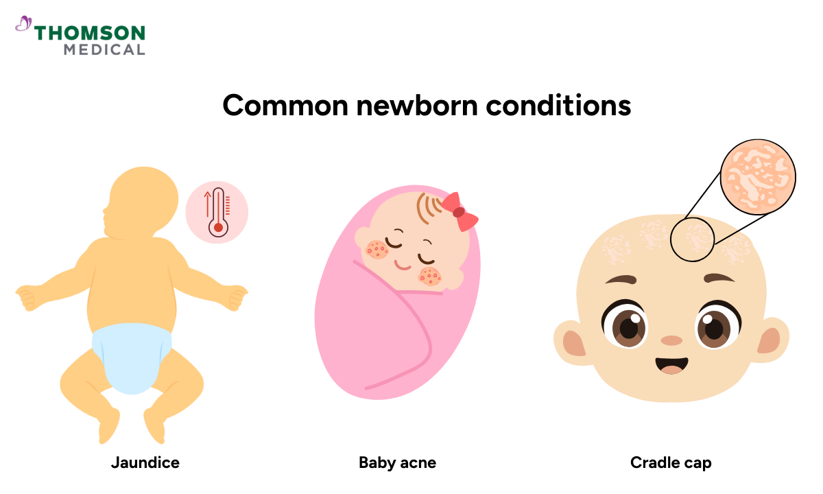 Illustration of common newborn baby conditions