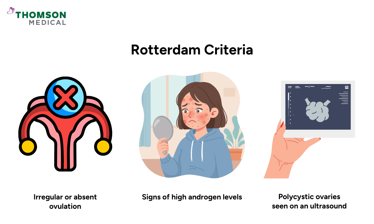 Illustration of Rotterdam Criteria