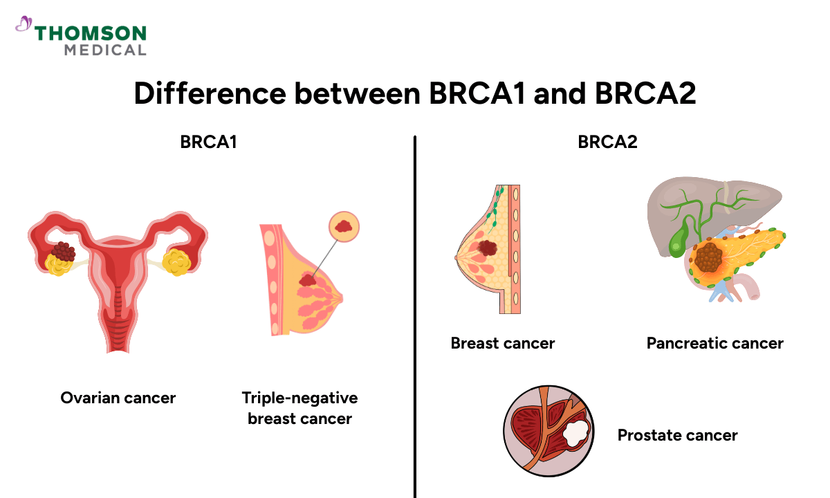 difference-between-brca1-and-brca2